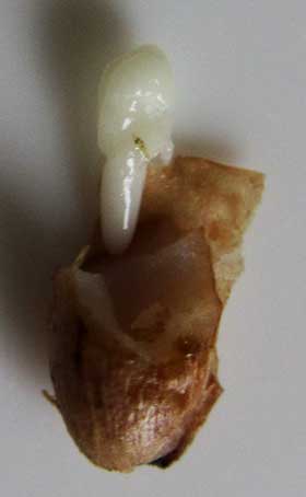 ツルニンジンの種子の中　胚乳と少し大きくなった胚